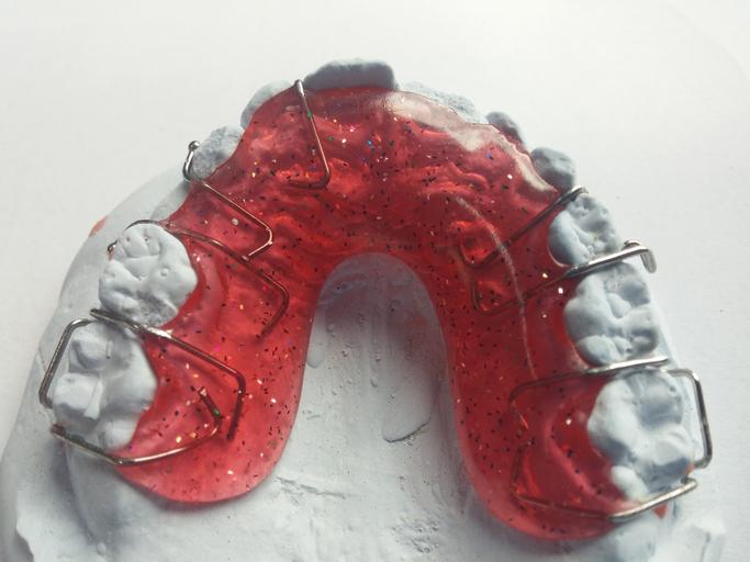 Léčba na ortodoncii vaše nedokonalosti napraví